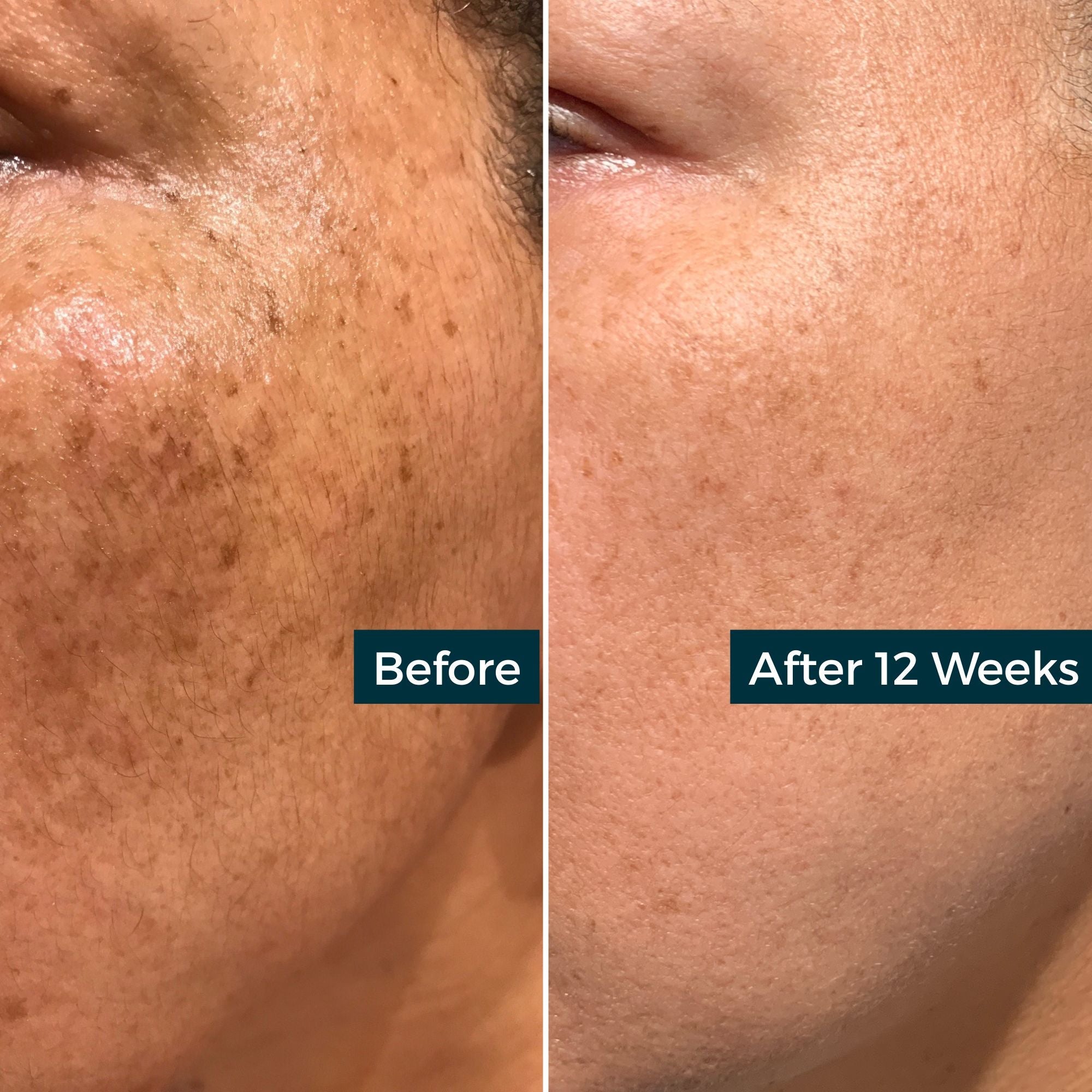 Retinol + Vitamin C Night Skin Refining Oil