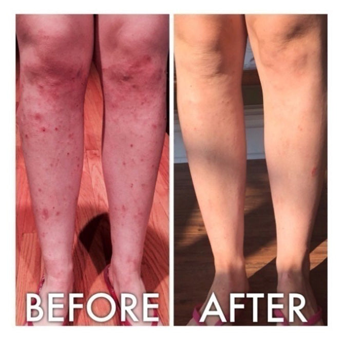 Derm #1 Dry Skin Rescue with Vitamin B3 3.38 oz